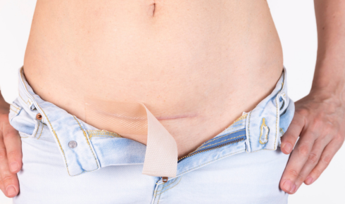 Sleep, Scars, and Soft Clothes That Actually Help